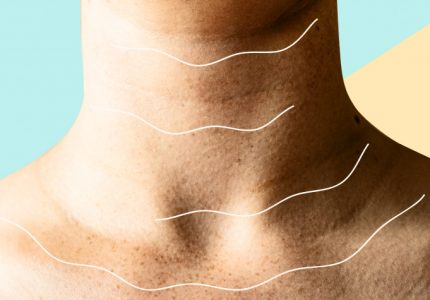 signs of neck aging